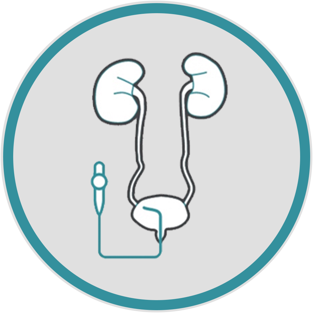 Endo-urology procedures